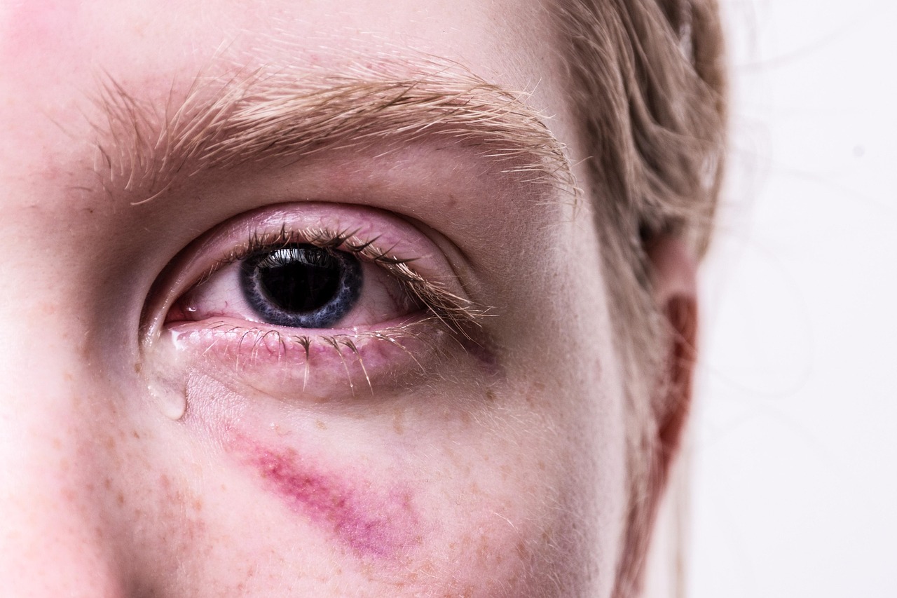 erfahren sie, wie kindheitstraumata das leben beeinflussen können. entdecken sie wege zur heilung und unterstützung für betroffene.